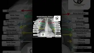 Radiograf&iacute;a de t&oacute;rax 🩻#radiograf&iacute;a #t&oacute;rax #rayosx #radiolog&iacute;a #medicina #estudiantedemedicina
