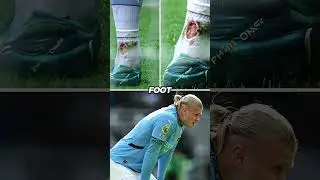 Erling Haaland missed a penalty and got injured ending his season 😞💔