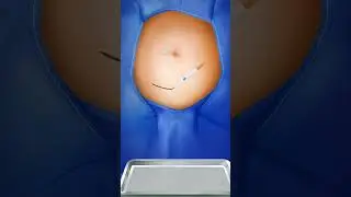 Last Month pregnant women in hospital for treatment and lovely