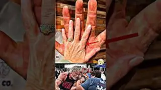 Bro is Not Human😱The Giant Arms.      #shorts #viral #bodybuilding #gymedits #trending