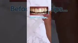 Brighten your smile with our guaranteed solution