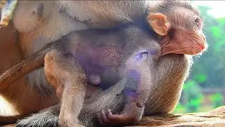 Million Sad Baby Lola Cry Hurt So Much,Leaning On Mommy Until Leyla Give Milk