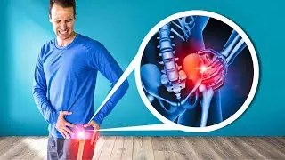 What Causes Hip Arthritis? (THE TRUTH)