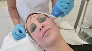 Clear + Brilliant at Lucia Clinic Dubai