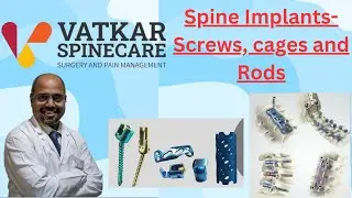 Revolutionary Spinal Implants: Titanium, Cobalt Chrome, PEEK – by Dr. Arvind Vatkar