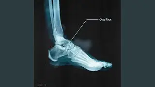 One Foot
