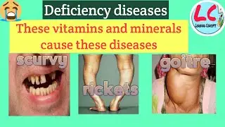 Deficiency Diseases | Science | Class 6 | in Hindi |
