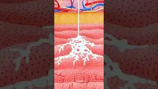 The Future of Vaccines: Needle-Free Injections