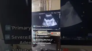 After 2 Failed IVF Transfers&hellip; ERA Test Gave Us Hope! 💫