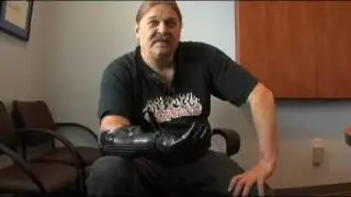 Prosthetic hand
