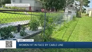 Owasso woman hit by downed cable line in her backyard