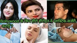 प्लास्टिक सर्जरी कराने वाले अभिनेता और अभिनेत्रियां🔥प्लास्टिक सर्जरी क्या है?