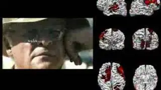 Brain Response To 