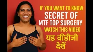 😱 MTF Top Surgery Secrets REVEALED! | Male to Female Breast Implant Transformation ✨ | #mustwatch