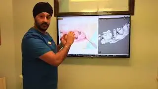 Nottingham dental implants appointment 6