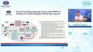 Vai trò thuốc ức chế PARP trong ung thư buồng trứng tiến triển