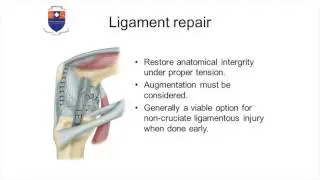 Ligament repair in the multiligament setting - Session 4 - 11h20 - Mphele Tladi