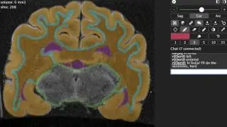 Open Neuroimaging Laboratory
