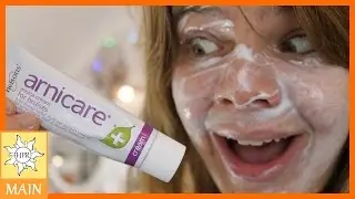 Arnicare Face Mask - How To Get Rid Of Bruises On The Face | Hannah Phillips Real