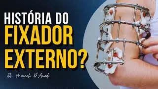 A HIST&Oacute;RIA E EVOLU&Ccedil;&Atilde;O DO FIXADOR EXTERNO CIRCULAR NA MEDICINA!