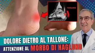 Protuberanza al tallone e dolore? Scopri il Morbo di Haglund | Dott. Andrea Scala