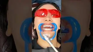 Что на самом деле происходит на первом приеме у специалиста по лечению Invisalign?