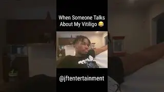 When Someone Talks About My Vitiligo 😂 #jft #funny #vitiligoawareness