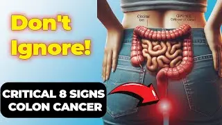 Critical 8 Early Warning Signs of Colon Cancer - DON'T IGNORE! / Health Videos