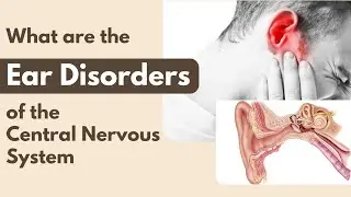 What Are The Ear Disorders Of The Central Nervous System? | #srianantha
