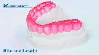 Bite occlusale / doccia per bruxismo