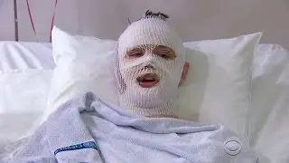 American victim describes Brussels airport bombing