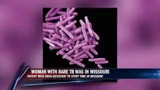 Woman with rare form of Tuberculosis visited Missouri
