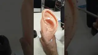 Scapha for treatment of pain in arm.