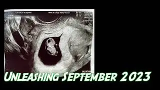 One in the Trap (Baby Announcement)