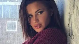 😱😱 Milla Jasmine avant les chirurgies 😱😱  #lerestedumonde #lmvsrdm #milla #millajasmine