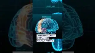 China makes new progress in invasive brain-computer interface trial