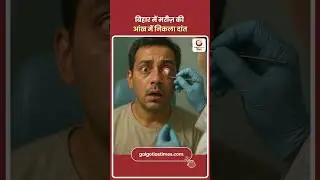 Rare Medical Case in IGIMS Patna: Shocking News: Tooth pulled out of patient's eye in Bihar