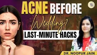 Bridal Skincare Routine for Glowing Skin 💫 | Pre Wedding Skincare Mistakes You MUST Avoid | Skinzest