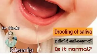 ഉമിനീർ ഒലിക്കുന്നത് എപ്പോളാണ് സീരിയസ് ആയി എടുക്കേണ്ടത്/Drooling of saliva in babies/Dr Bindu