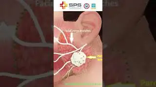 Parotid Glands Explained: Functions, Disorders & Treatments | SPS Hospitals
