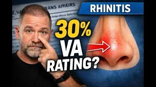 Rhinitis VA Rating Explained (How Some Vets Get 30%)