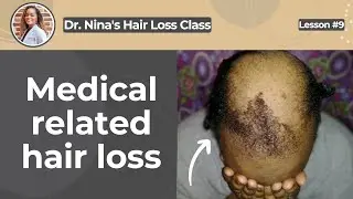 Dr. Nina's Hair Loss Class | Lesson 09 - Medical related hair loss