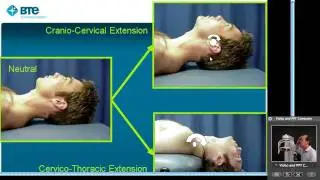 BTE MCU Chronic Neck Pain Rehab Webcast Part 2 of 8