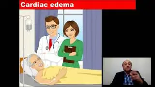 Cardiac edema #cme #internal_medicine #usmle #medical #medicalcollege #doctor  #محاضرات_باطنة