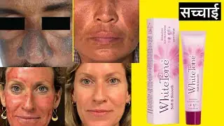 White tone cream | white tone cream review | white tone side effects benefits how to use results