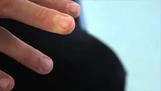 Capillaire refill
