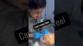 Acne scar treatment for post pimple scars on face at delhi by dr anvika | #acnescars #acneclinic