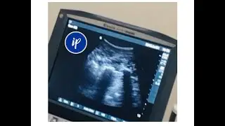 The SOAPBOX- Multifidus on LIVE ULTRASOUND!!!