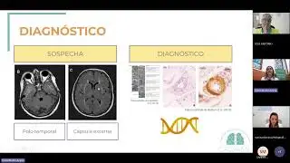 Identificación de fármacos para mejorar la calidad de vida en CADASIL