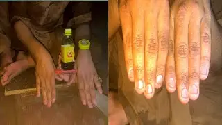 Hand massage finger cutting ✂️ therapy ticqneus TRY NOT TO carpal pain smoothing treatment||